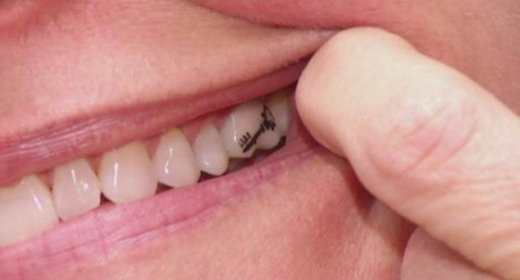 tateeth-dcdental-alcorcon-clinica-dental